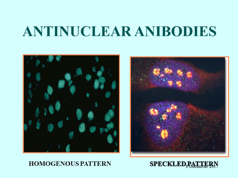 ANTINUCLEAR ANIBODIES HOMOGENOUS PATTERN      SPECKLED PATTERN   